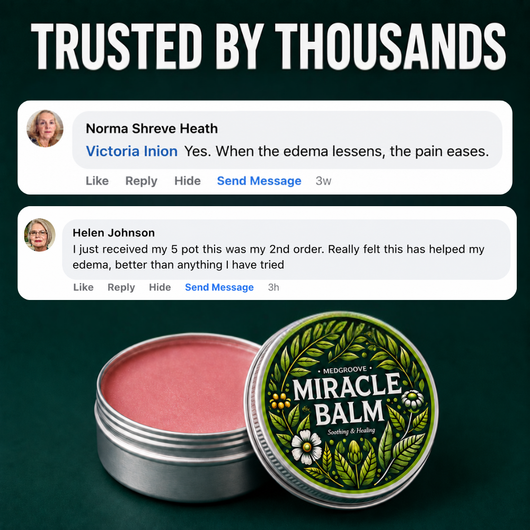 SwellBalm - The Miracle Balm For Leg Edema & Swelling